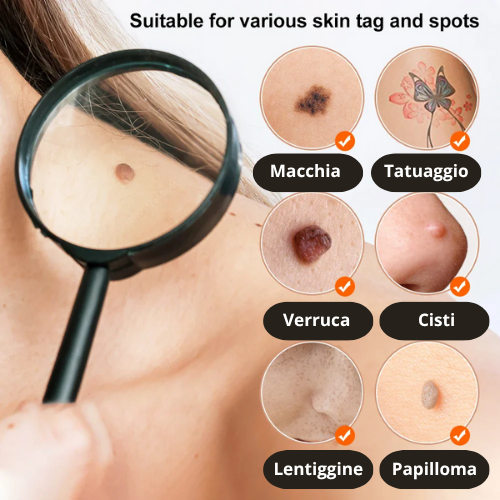 Penna Estetica Professionale al Plasma |Trattamento per Rughe, Macchie, Acne, Verruche e Tatuaggi| Ricaricabile USB-C | Tecnologia Sicura e Naturale.