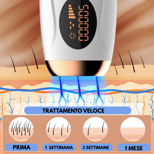 Epilatore a Luce Pulsata IPL – Laser Permanente, Indolore e Professionale per Viso, Corpo, Ascelle e Zona Bikini.