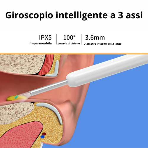 Strumento per la pulizia delle orecchie con telecamera e luce LED ad alta precisione. Wireless, con kit accessori.