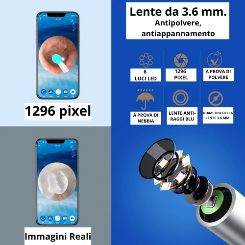 Strumento per la pulizia delle orecchie con telecamera e luce LED ad alta precisione. Wireless, con kit accessori.