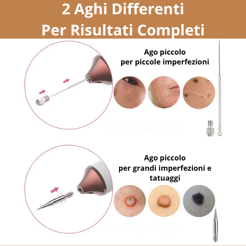 Penna Estetica Professionale al Plasma |Trattamento per Rughe, Macchie, Acne, Verruche e Tatuaggi| Ricaricabile USB-C | Tecnologia Sicura e Naturale.