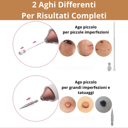 Penna Estetica Professionale al Plasma |Trattamento per Rughe, Macchie, Acne, Verruche e Tatuaggi| Ricaricabile USB-C | Tecnologia Sicura e Naturale.