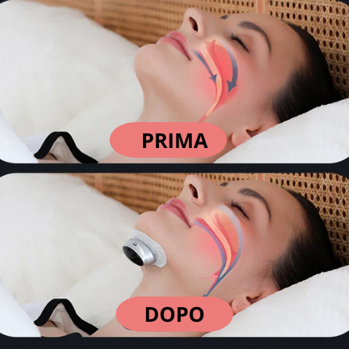 New Smart Anti Snoring Device Stop Snoring Dual Pulse Muscle Stimulator Anti Sleep Snoring Breathing Corrector Health Care