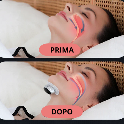 New Smart Anti Snoring Device Stop Snoring Dual Pulse Muscle Stimulator Anti Sleep Snoring Breathing Corrector Health Care